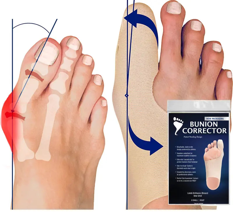Stridewell™ – Ultra-Thin Bunion Corrector Sleeve for Big Toe Alignment &amp; All-Day Comfort + 50% OFF