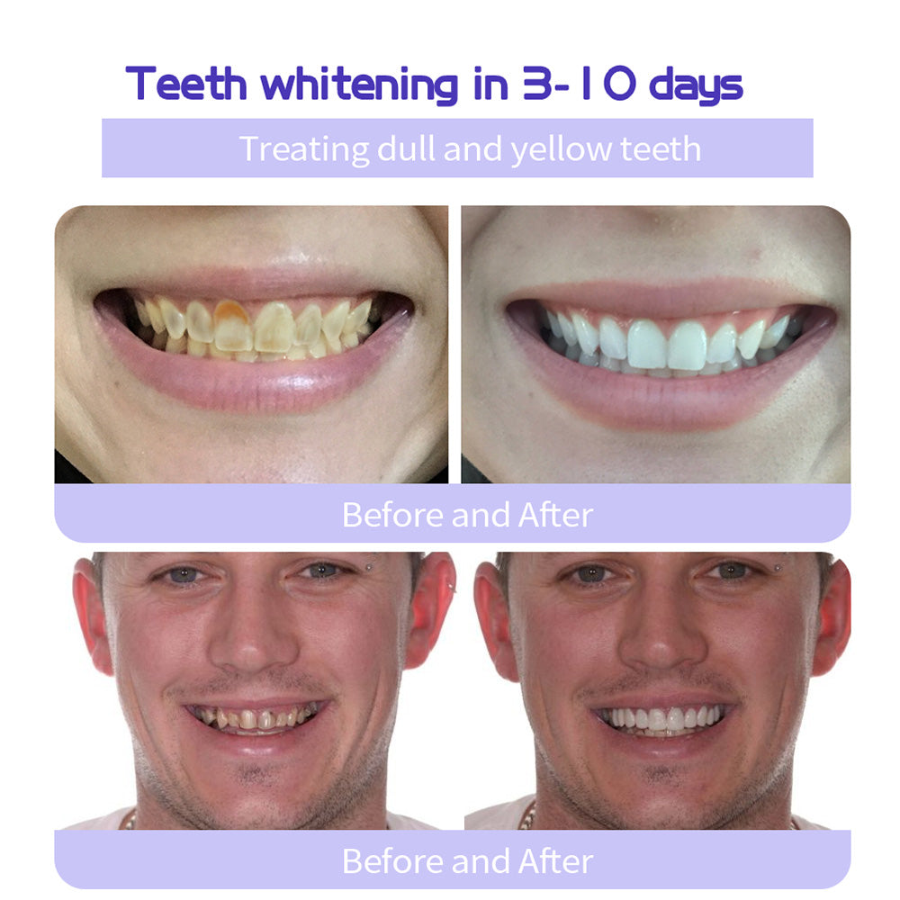 Odalit – Rebuild Gums &amp; Save Teeth + 50% OFF