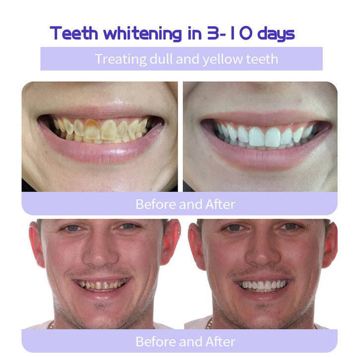 Odalit – Rebuild Gums &amp; Save Teeth + 50% OFF