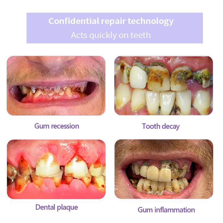 The RestoreGum Mineral Powder - Dentist-Approved, TGA Recommended for Gum &amp; Tooth Repair + 50% OFF