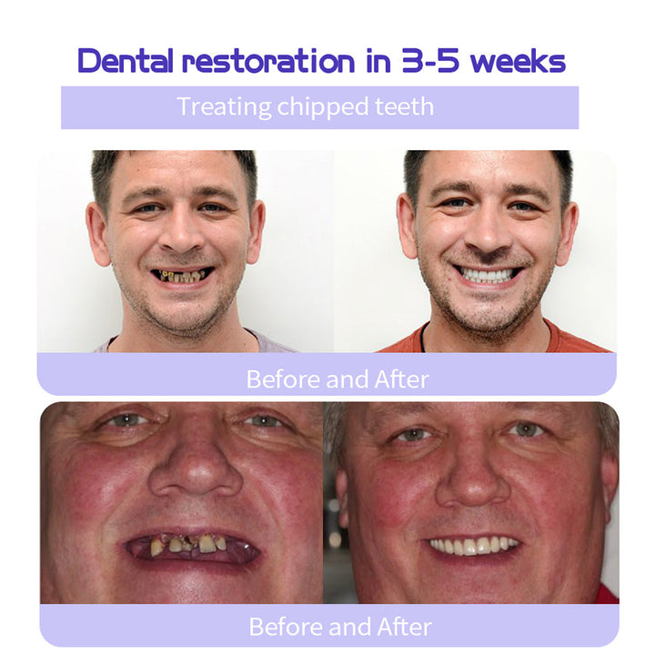 Odalit – Rebuild Gums &amp; Save Teeth + 50% OFF