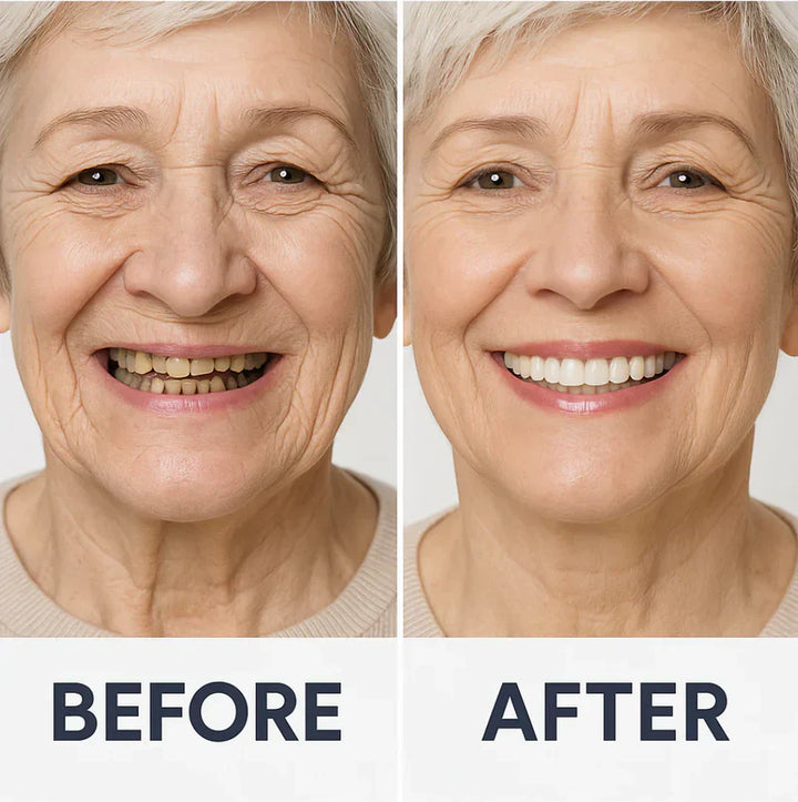 NaturaFit Dentures - The No-Slip, Custom-Fit Smile + 50% OFF