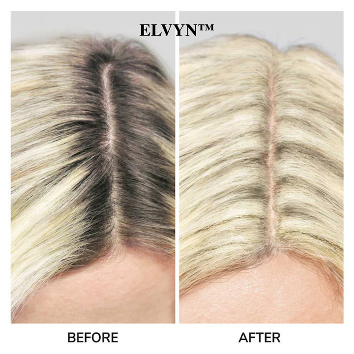 ElvynGloss - Achieve flawless roots instantly. + 50% OFF