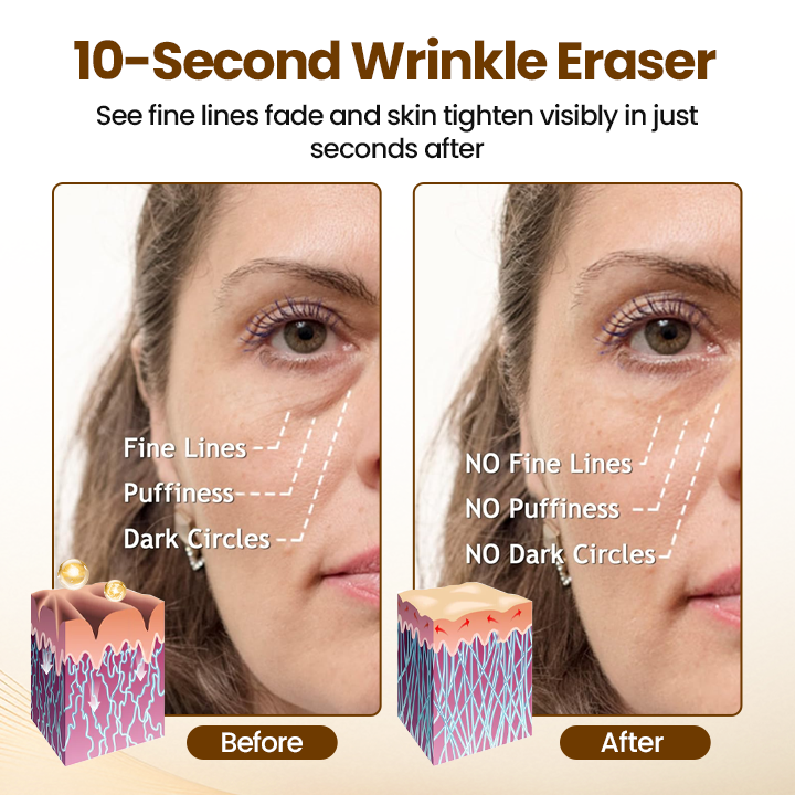 The AuraSmooth Wrinkle Serum – Soothing Rollerball with Anti-Aging Properties + 50% OFF