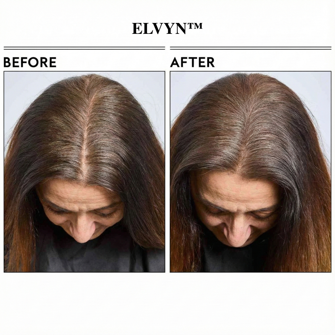 ElvynGloss - Achieve flawless roots instantly. + 50% OFF