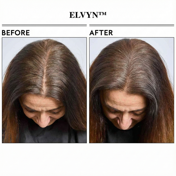 ElvynGloss - Achieve flawless roots instantly. + 50% OFF