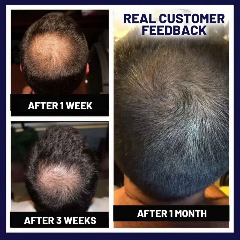 NaturaRevive Hair Spray - 5x Faster Hair Growth + 50% OFF