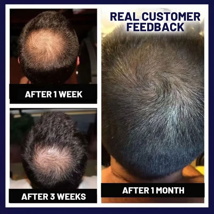 NaturaRevive Hair Spray - 5x Faster Hair Growth + 50% OFF