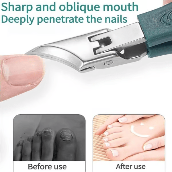 PrecisionGrip Pro - Effortless Ingrown Nail &amp; Thick Nail Solution - 50% OFF