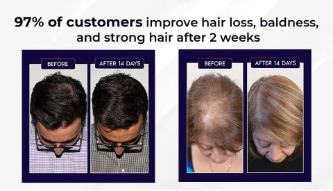 NaturaRevive Hair Spray - 5x Faster Hair Growth + 50% OFF