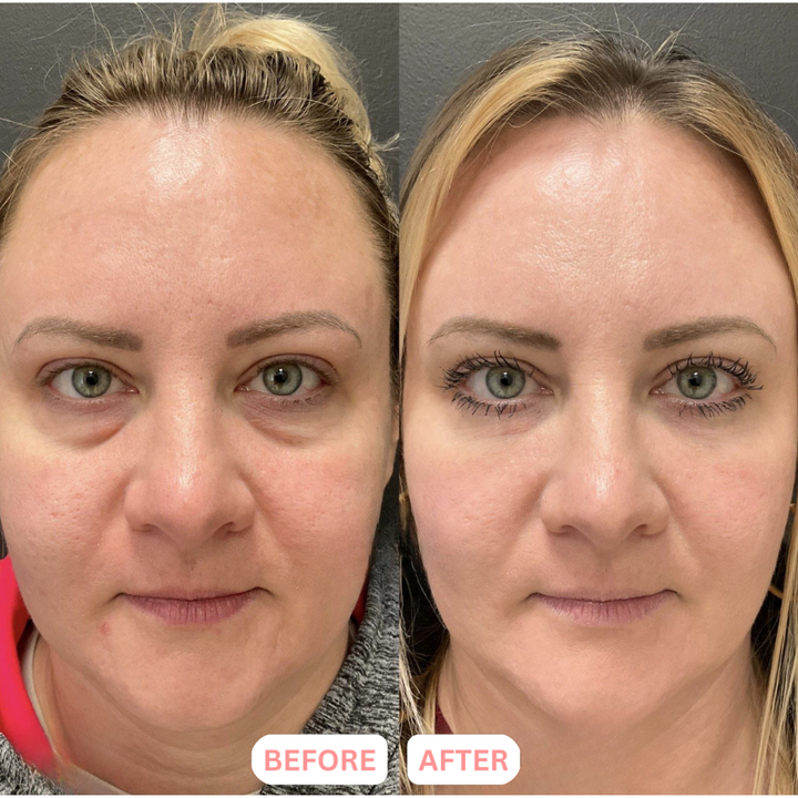 The ContourLift Face Brush - Eliminate Double Chin &amp; Reduce Puffiness + 50% OFF