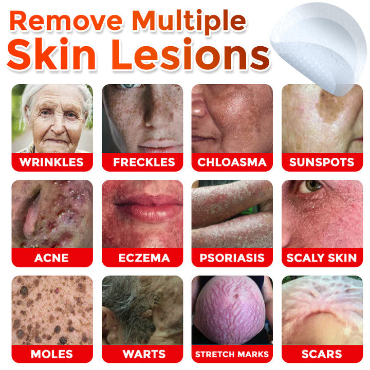 The AuraClear Skin Tag Patch - Botanic MicroNeedle Removal, Visible Results + 50% OFF