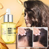 Folli-Gen - Reawaken Your Hair's Fullness - 50% OFF