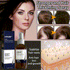 NaturaRevive Hair Spray - 5x Faster Hair Growth + 50% OFF
