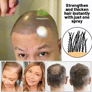 NaturaRevive Hair Spray - 5x Faster Hair Growth + 50% OFF