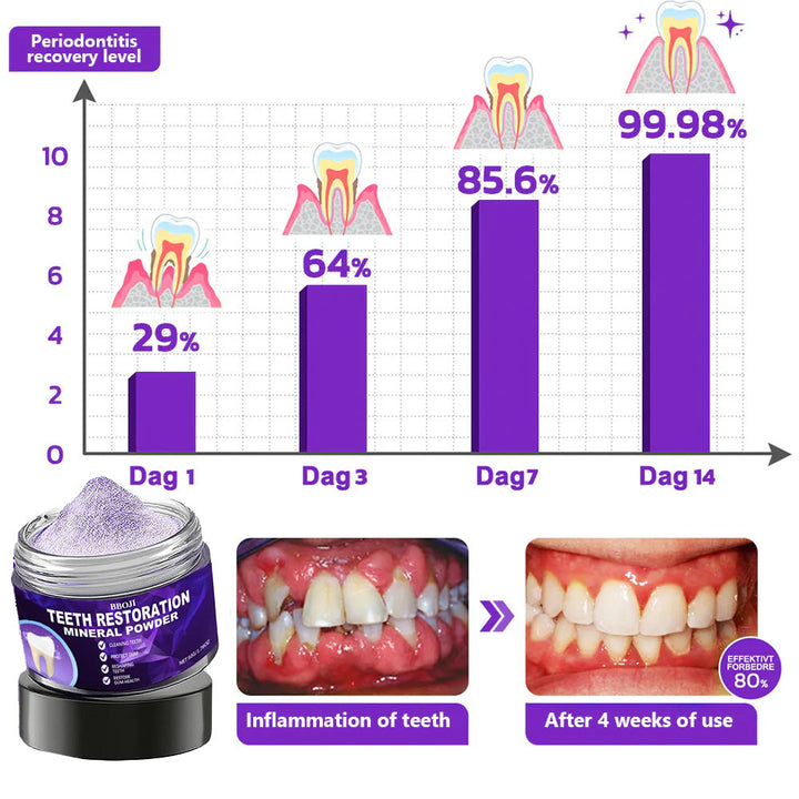 BBOJI Bio-Mineral Restore — Reverse recession &amp; save your teeth. +50% OFF