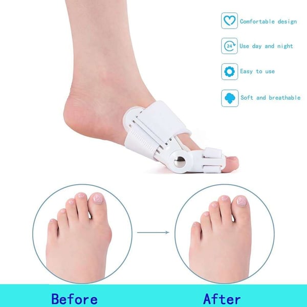 Solea™ – Adjustable Hinged Bunion Corrector with Soft Metatarsal Pad + 50% OFF
